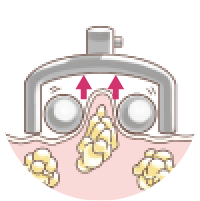 回転で巻き上げ